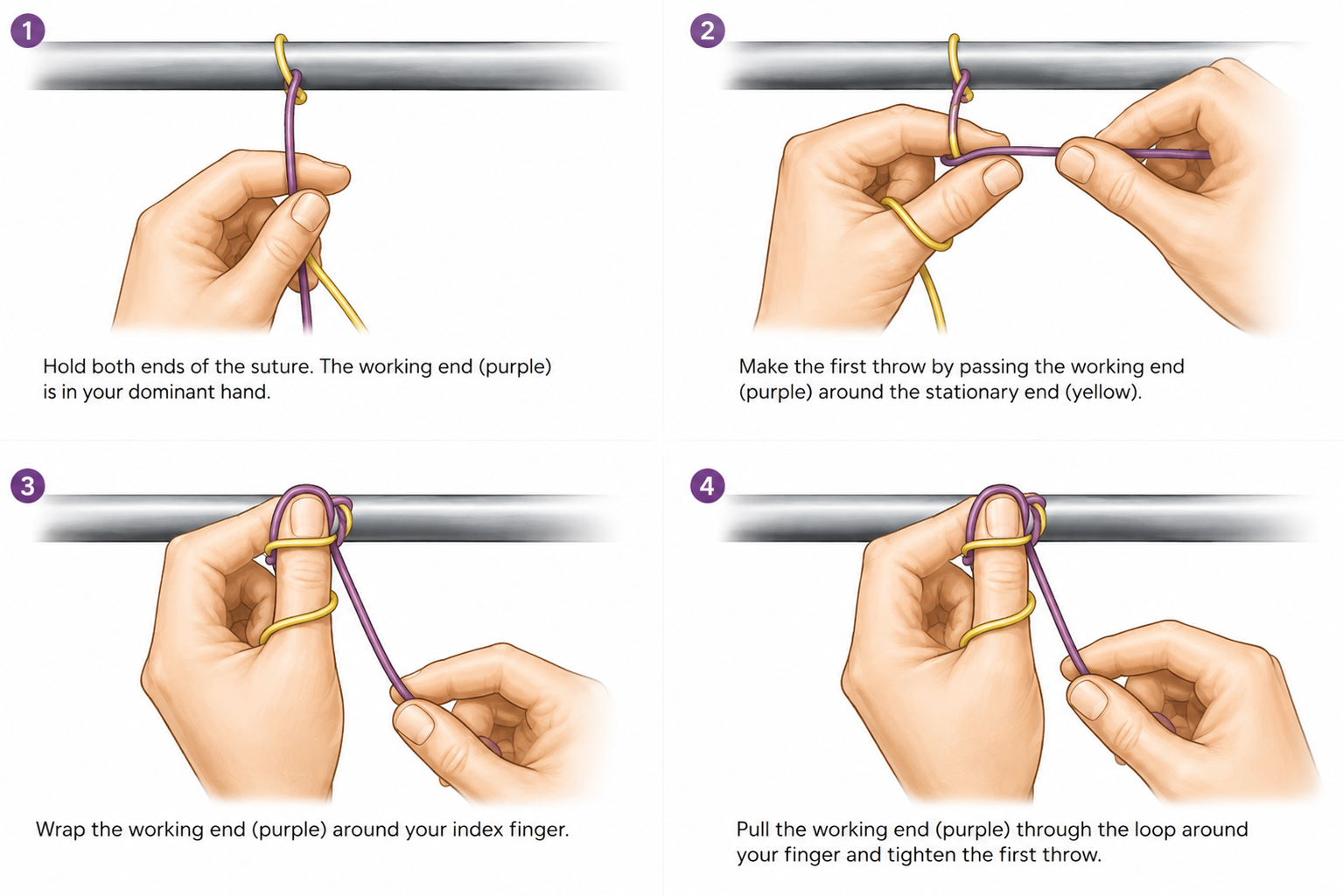 Two-Hand Tie: A Step-by-Step Guide for Operating Room Nurses Two-Hand Tie: A Step-by-Step Guide for Operating Room Nurses
